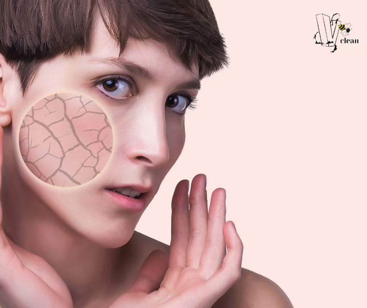 Nine Tips Dermatology recommend for naturally dry skin